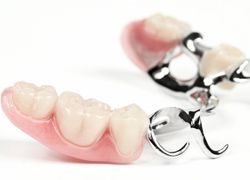 Бюгельное протезирование