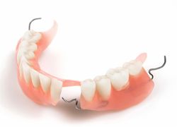 Частичное съемное протезирование